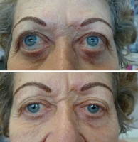 /album/fotogalerie/oboci-10-2-17-3-jpg/